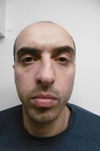 Wizerunek poszukiwanego mężczyzny.